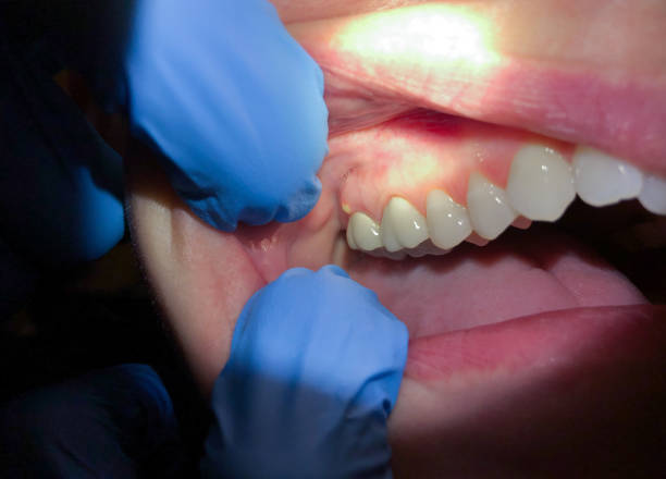 Best Pediatric Emergency Dentist in Wabasha, MN